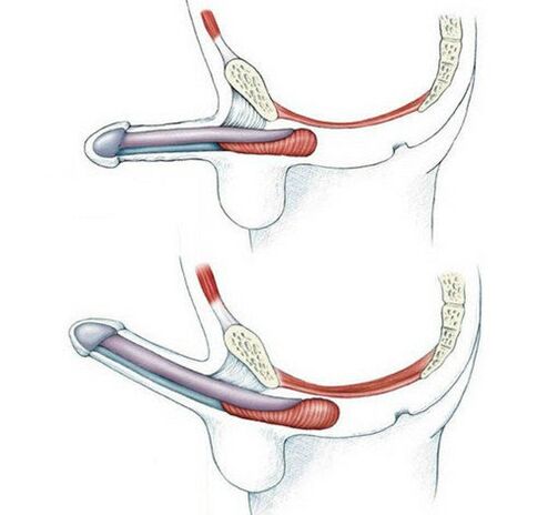 Penis without training the pubococcygeus muscle and afterwards