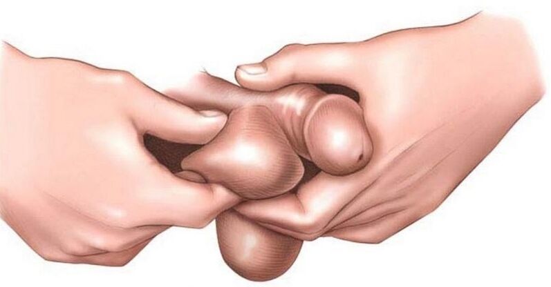 Why itching eggs in men